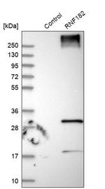 RNF182 Antibody in Western Blot (WB)