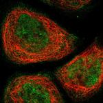 PHTF2 Polyclonal Antibody