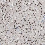 PHTF2 Antibody in Immunohistochemistry (Paraffin) (IHC (P))