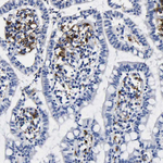 HLA-DQA1 Polyclonal Antibody