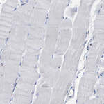 HLA-DQA1 Antibody in Immunohistochemistry (Paraffin) (IHC (P))