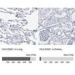 HLA-DQA1 Antibody in Immunohistochemistry (IHC)