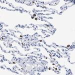 HLA-DQA1 Antibody in Immunohistochemistry (IHC)