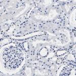 HLA-DQA1 Antibody in Immunohistochemistry (IHC)