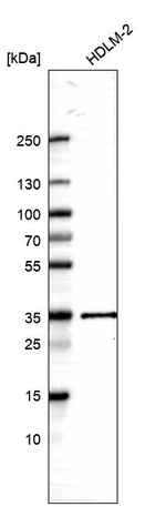 HLA-DQA1 Antibody in Western Blot (WB)