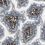 GRAMD1C Polyclonal Antibody