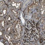 GRAMD1C Antibody in Immunohistochemistry (IHC)
