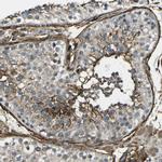 GRAMD1C Antibody in Immunohistochemistry (IHC)