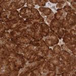MRPL52 Antibody in Immunohistochemistry (Paraffin) (IHC (P))