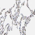 CD93 Antibody in Immunohistochemistry (IHC)