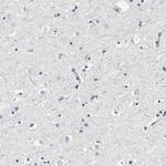 FMO5 Antibody in Immunohistochemistry (IHC)