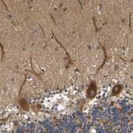 LRCH3 Antibody in Immunohistochemistry (Paraffin) (IHC (P))