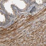 LRCH3 Antibody in Immunohistochemistry (Paraffin) (IHC (P))
