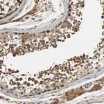 LRCH3 Antibody in Immunohistochemistry (Paraffin) (IHC (P))