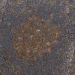 LRCH3 Antibody in Immunohistochemistry (Paraffin) (IHC (P))