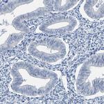 PP11 Antibody in Immunohistochemistry (Paraffin) (IHC (P))