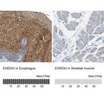 PP11 Antibody in Immunohistochemistry (IHC)