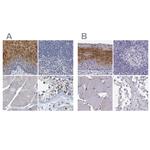 PP11 Antibody in Immunohistochemistry (IHC)