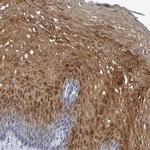 PP11 Antibody in Immunohistochemistry (IHC)