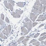 PP11 Antibody in Immunohistochemistry (IHC)
