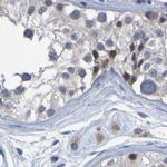 PP11 Antibody in Immunohistochemistry (IHC)