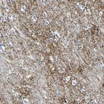 OTOF Antibody in Immunohistochemistry (IHC)
