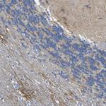 OTOF Antibody in Immunohistochemistry (Paraffin) (IHC (P))