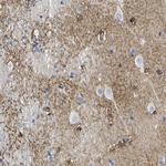 OTOF Antibody in Immunohistochemistry (Paraffin) (IHC (P))