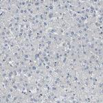 OTOF Antibody in Immunohistochemistry (Paraffin) (IHC (P))