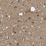 CLSTN1 Antibody in Immunohistochemistry (Paraffin) (IHC (P))