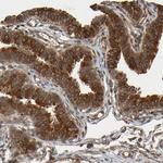 OCRL Polyclonal Antibody