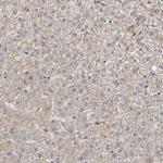 OCRL Antibody in Immunohistochemistry (Paraffin) (IHC (P))