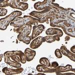 OCRL Antibody in Immunohistochemistry (Paraffin) (IHC (P))