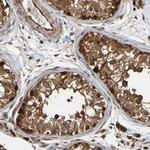 OCRL Antibody in Immunohistochemistry (Paraffin) (IHC (P))
