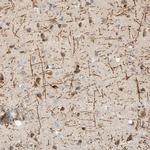 MAG Antibody in Immunohistochemistry (IHC)