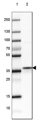 FBP1/FBP2 Antibody in Western Blot (WB)