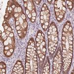 TMED6 Antibody in Immunohistochemistry (Paraffin) (IHC (P))