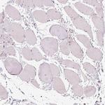 TMED6 Antibody in Immunohistochemistry (Paraffin) (IHC (P))