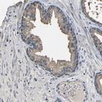 C6orf89 Antibody in Immunohistochemistry (Paraffin) (IHC (P))