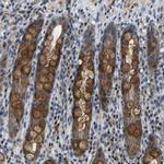 C6orf89 Antibody in Immunohistochemistry (Paraffin) (IHC (P))
