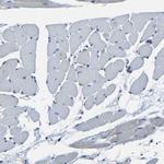 C6orf89 Antibody in Immunohistochemistry (Paraffin) (IHC (P))