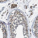 C6orf89 Antibody in Immunohistochemistry (Paraffin) (IHC (P))