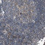 BTN3A1 Polyclonal Antibody