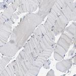 BTN3A1 Antibody in Immunohistochemistry (Paraffin) (IHC (P))