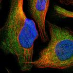 CYP26B1 Polyclonal Antibody