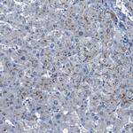 CDHR2 Antibody in Immunohistochemistry (IHC)