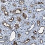 CDHR2 Antibody in Immunohistochemistry (IHC)