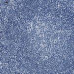 CDHR2 Antibody in Immunohistochemistry (IHC)