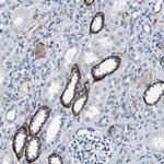 GRAMD1A Polyclonal Antibody