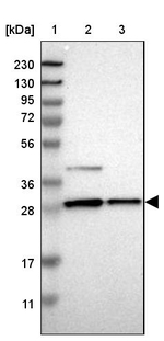 AZGP1 Antibody in Western Blot (WB)